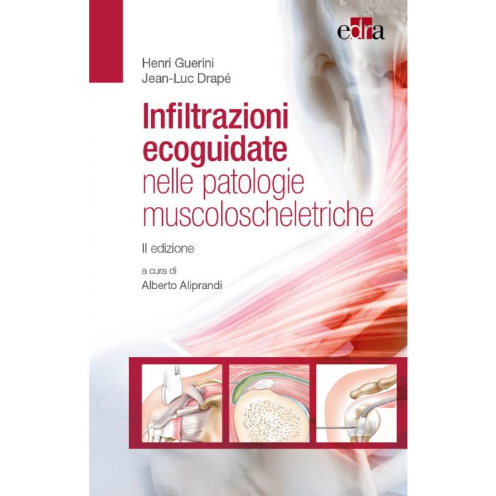 Infiltrazioni ecoguidate nelle patologie muscoloscheletriche guerini henri drapè edra Infiltrazioni ecoguidate nelle patologie muscoloscheletriche guerini henri drapè edra