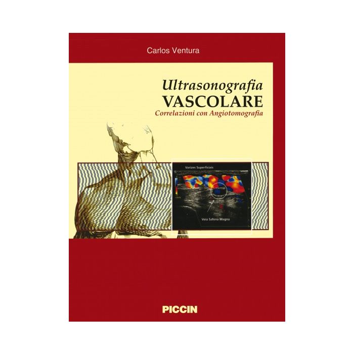 Ultrasonografia vascolare - Correlazioni con angiotomografia Ventura Carlos Piccin Editore Ultrasonografia vascolare - Correlazioni con angiotomografia Ventura Carlos Piccin Editore