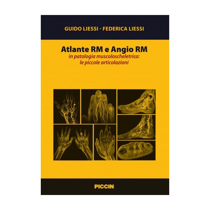 Atlante Rm e Angio Rm in patologia muscoloscheletrica: le piccole articolazioni Liessi Guido; Liessi Federica Piccin Editore 9788829927791 Atlante Rm e Angio Rm in patologia muscoloscheletrica: le piccole articolazioni Liessi Guido; Liessi Federica Piccin Editore 9788829927791