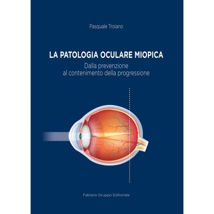 La patologia oculare miopica dalla prevenzione al contenimento della progressione pasquale troiano fabiano editore La patologia oculare miopica dalla prevenzione al contenimento della progressione pasquale troiano fabiano editore