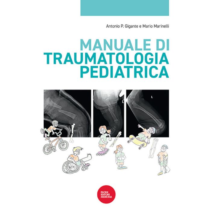 Manuale di traumatologia pediatrica gigante marinelli pacini editore