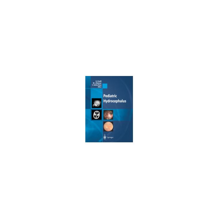 Pediatric Hydrocephalus - Cinalli G. ; Maixner W. J. ; Sainte-rose C. - Springer Verlag Italia - 9788847002258 Pediatric Hydrocephalus - Cinalli G. ; Maixner W. J. ; Sainte-rose C. - Springer Verlag Italia - 9788847002258