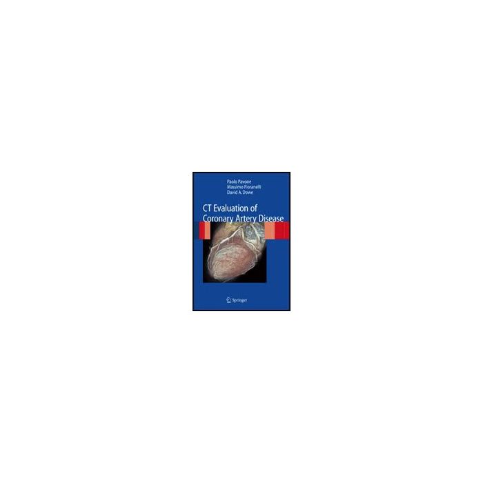 Ct Evaluation Of Coronary Artery Disease - Pavone Paolo; Fioranelli Massimo; Dowe David A. - Springer Verlag Italia - 9788847011250 Ct Evaluation Of Coronary Artery Disease - Pavone Paolo; Fioranelli Massimo; Dowe David A. - Springer Verlag Italia - 9788847011250