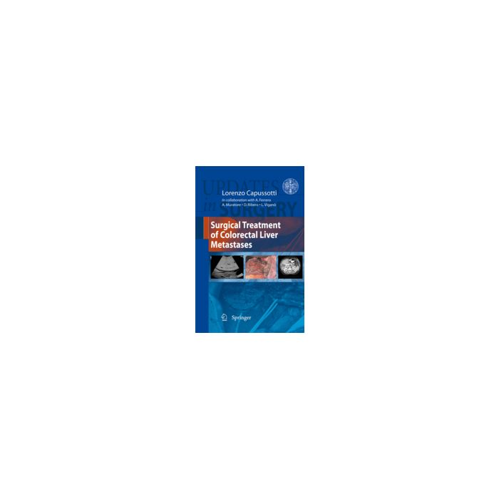 Surgical Treatment Of Colorectal Liver Metastases - Ferrero Alessandro; Muratore Andrea; Ribero Dario; Capussotti L.  - Springer Verlag Italia - 9788847018082