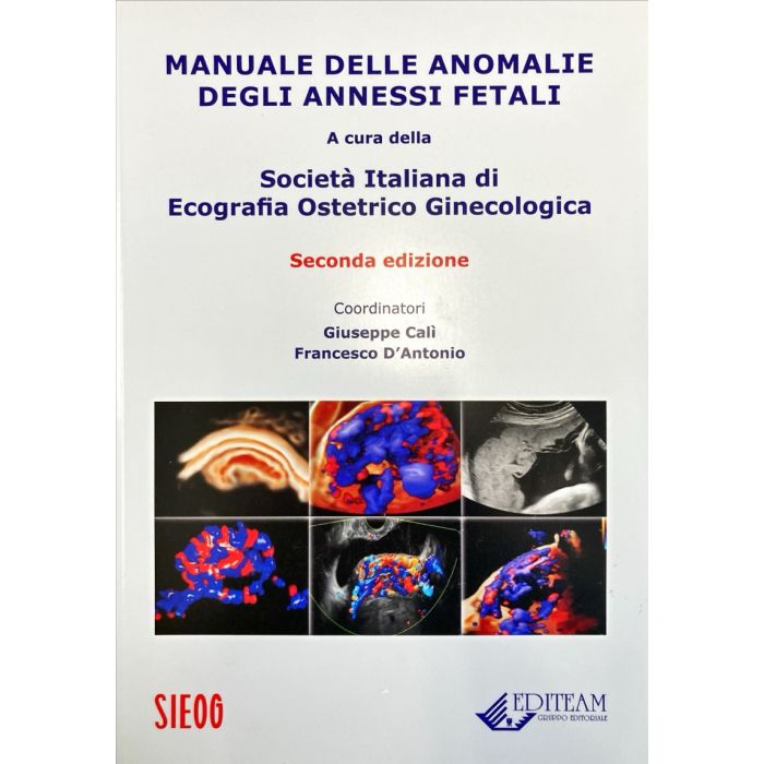 Manuale delle anomalie degli annessi fetali - SIEOG SIEOG - Società Italiana di Ecografia Ostetrico Ginecologica; Cali Giuseppe d'antonio francesco Manuale delle anomalie degli annessi fetali - SIEOG SIEOG - Società Italiana di Ecografia Ostetrico Ginecologica; Cali Giuseppe d'antonio francesco