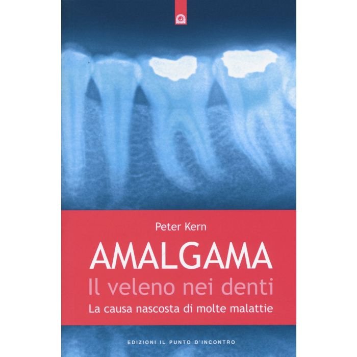 Amalgama: il veleno nei denti. La causa nascosta di molte malattie  Kern Peter  Il Punto d'Incontro  9788868201784
