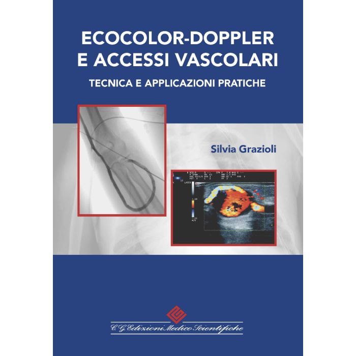 Ecocolor doppler e accessi vascolari tecnica e applicazioni pratiche silvia grazioli cg edizioni medico scientifiche