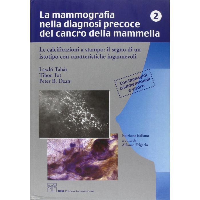 TABAR Calcificazioni a stampo il segno di un istotipo La mammografia nella dignosi precoce della mammella TABAR Calcificazioni a stampo il segno di un istotipo La mammografia nella dignosi precoce della mammella