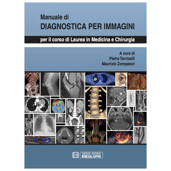 Manuale di Diagnostica per Immagini. Per i corsi di laurea in Medicina e Chirurgia Torricelli Pietro; Zompatori Maurizio Esculapio 9788874889198 Manuale di Diagnostica per Immagini. Per i corsi di laurea in Medicina e Chirurgia Torricelli Pietro; Zompatori Maurizio Esculapio 9788874889198