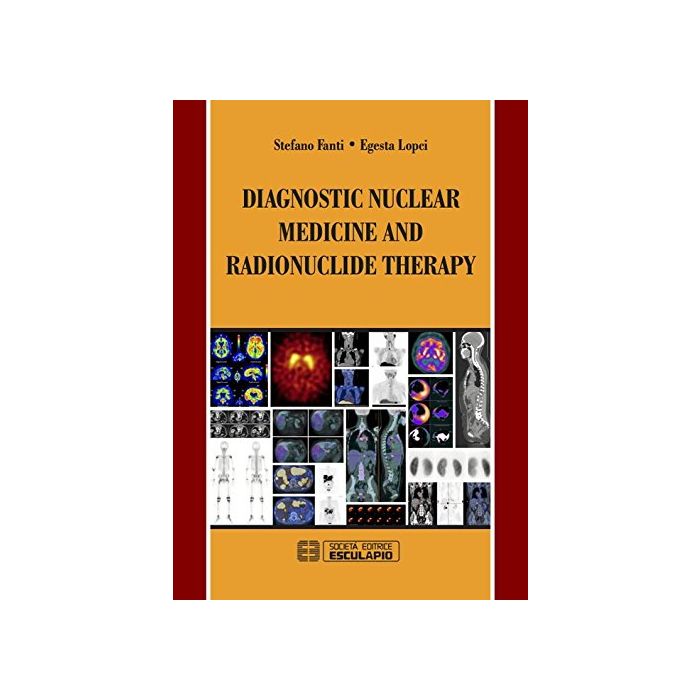 Diagnostic Nuclear Medicine and Radionuclide Therapy  Fanti Stefano; Lopci Egesta  Esculapio  9788874889617