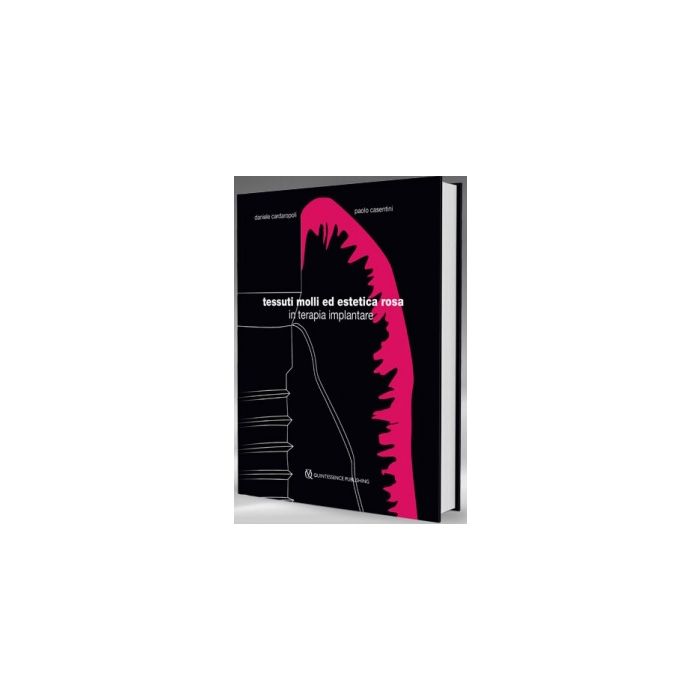 Cardaropoli Casentini Tessuti molli ed estetica rosa in Terapia Implantare Cardaropoli Casentini Tessuti molli ed estetica rosa in Terapia Implantare