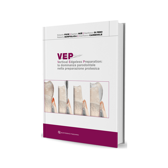 vep vertical edgeless preparation la dominanza parodontale nella preparazione protesica foce noe bonfiglioli quintessenza vep vertical edgeless preparation la dominanza parodontale nella preparazione protesica foce noe bonfiglioli quintessenza