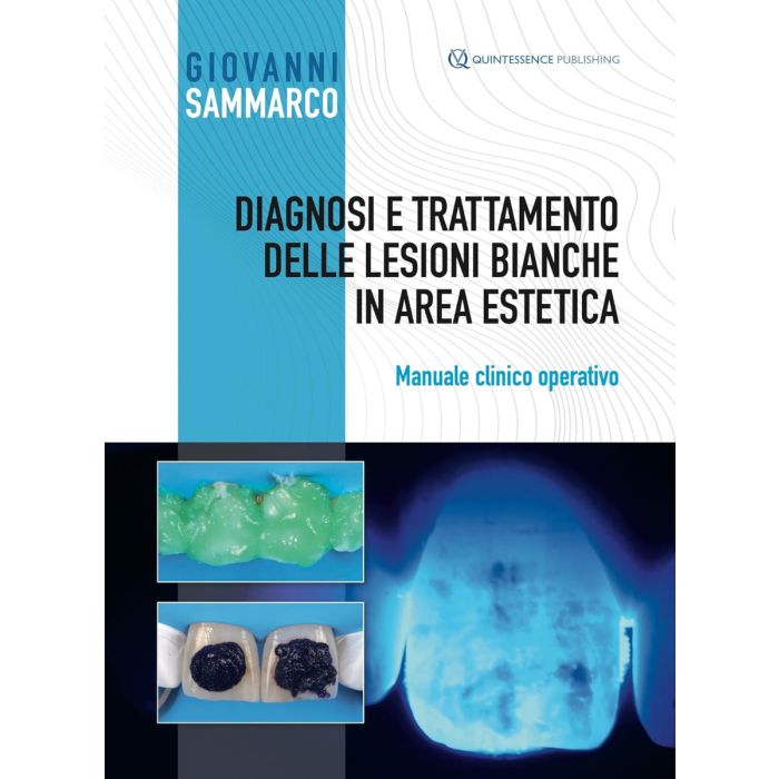 Sammarco Diagnosi e trattamento delle lesioni bianche in area estetica quintessenza