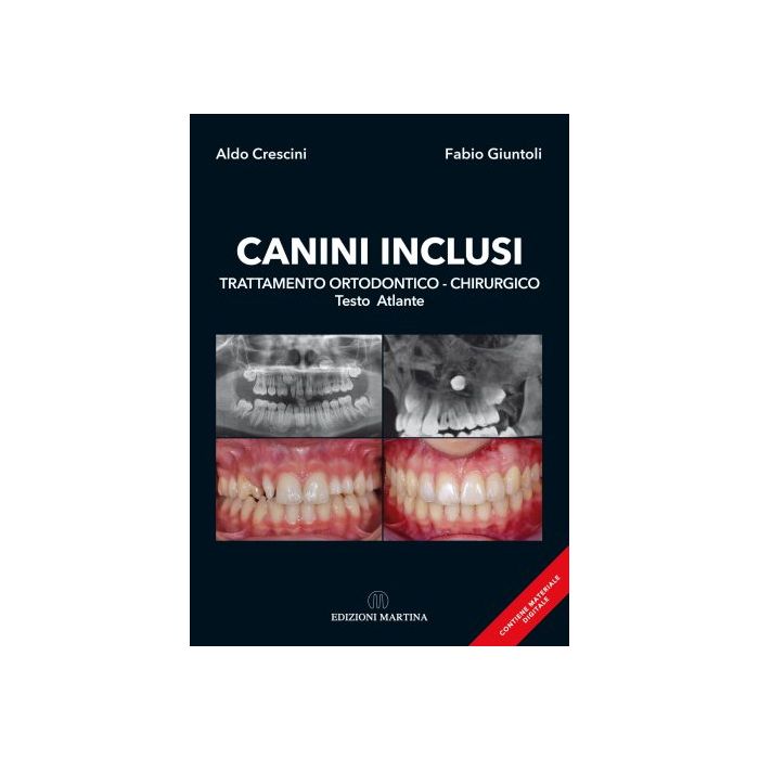 Canini inclusi trattamento ortodontico chirurgico aldo crescini fabio giuntoli martina editore
