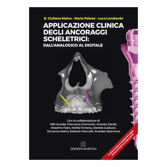 Applicazione clinica degli ancoraggi scheletrici dall'analogico al digitale giuliano maino mario palone martina edizioni