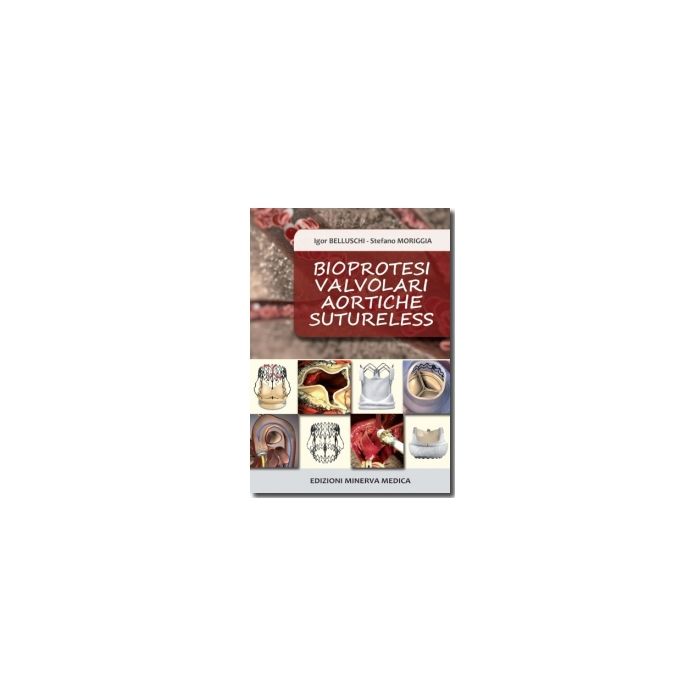 Bioprotesi valvolari aortiche sutureless Moriggia Stefano; Belluschi Igor Minerva Medica 9788877117601 Bioprotesi valvolari aortiche sutureless Moriggia Stefano; Belluschi Igor Minerva Medica 9788877117601