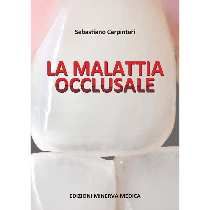 La malattia occlusale  Carpinteri Sebastiano  Minerva Medica  9788877118448