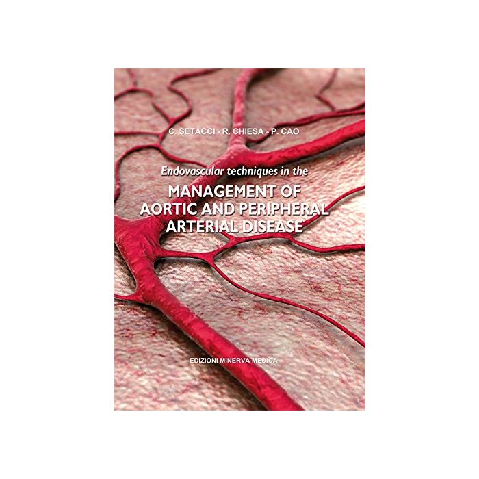Endovascular techniques in the management of aortic and peripheral arterial disease  Setacci Carlo; Chiesa Roberto; Cao Piergiorgio  Minerva Medica  9788877118561 Endovascular techniques in the management of aortic and peripheral arterial disease  Setacci Carlo; Chiesa Roberto; Cao Piergiorgio  Minerva Medica  9788877118561