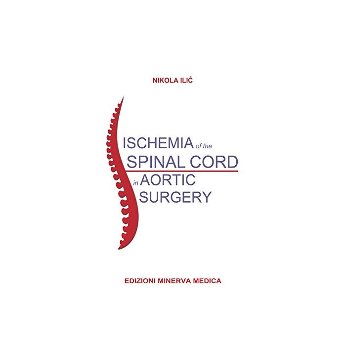 Ischemia of the spinal cord in aortic surgery Ilic Nikola Minerva Medica 9788877118653 Ischemia of the spinal cord in aortic surgery Ilic Nikola Minerva Medica 9788877118653
