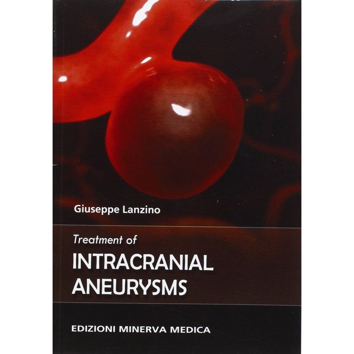 Treatment of intracranial aneurysms  Lanzino Giuseppe  Minerva Medica  9788877118707
