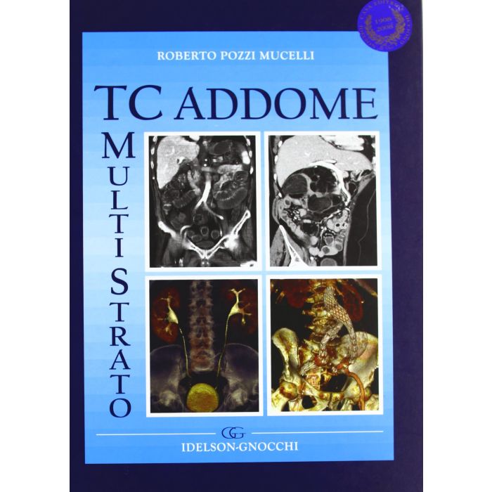 TC ADDOME POZZI MUCELLI IDELSON GNOCCHI TC ADDOME POZZI MUCELLI IDELSON GNOCCHI