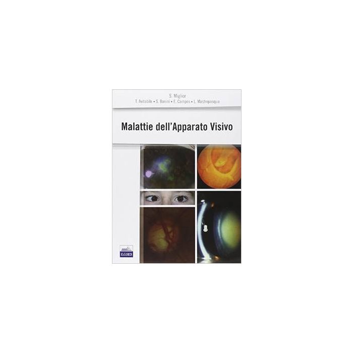 Malattie dell’Apparato Visivo  [Miglior - Edises]
