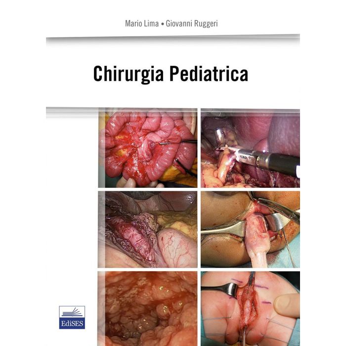 Chirurgia Pediatrica      [Lima - Edises]