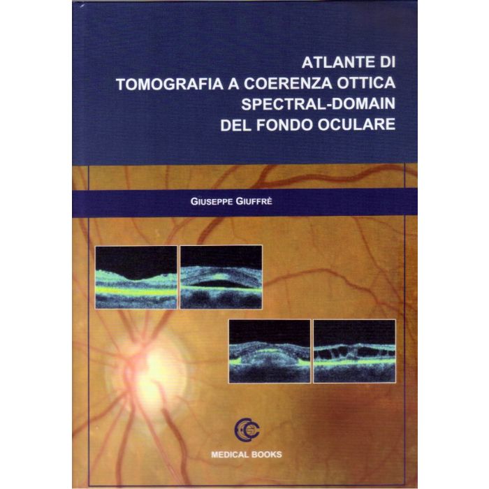 Atlante di Tomografia a coerenza ottica: Spectral - Domain del Fondo Oculare  [Giuffrè Giuseppe - Medical Books]