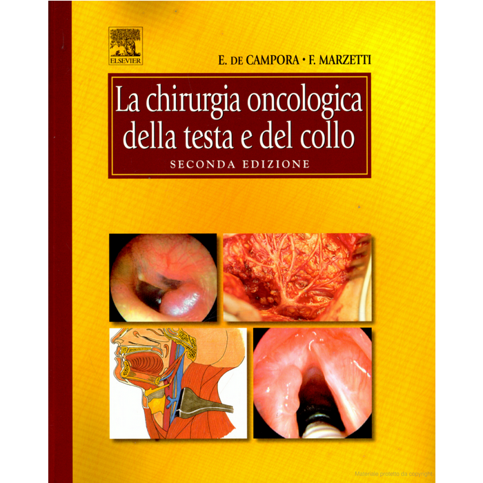 De Campora La chirurgia oncologia della testa e del collo elsevier masson libro De Campora La chirurgia oncologia della testa e del collo elsevier masson libro