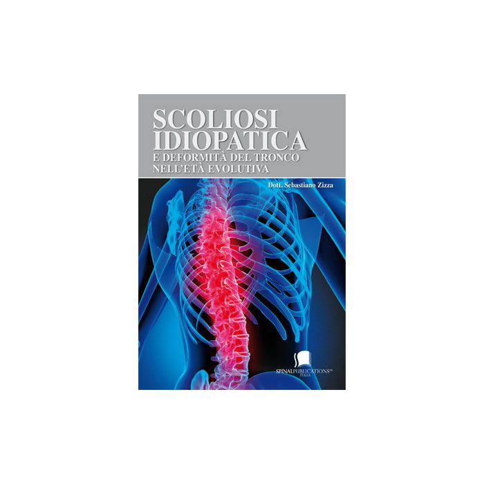 Scoliosi Idiopatica e deformità del tronco nell'età evolutiva sebastiano zicca Scoliosi Idiopatica e deformità del tronco nell'età evolutiva sebastiano zicca