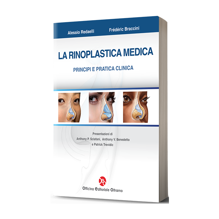 La rinoplastica Medica Principi e pratica clinica Alessio Redaelli Frederic Braccini Officina editoriale oltrarno oeo La rinoplastica Medica Principi e pratica clinica Alessio Redaelli Frederic Braccini Officina editoriale oltrarno oeo