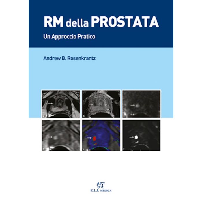 Rosenkrantz RM della Prostata Risonanza Magnetica