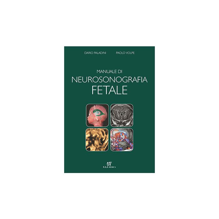Manuale di neurosonologia fetale paladini dario volpe paolo eli medica