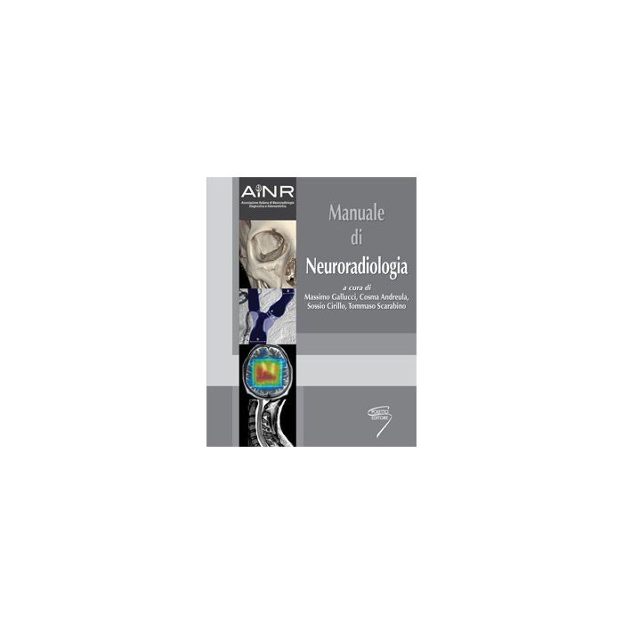 Manuale di neuroradiologia Gallucci Massimo; Andreula Cosma; Cirillo Sossio; Scarabino Tommaso Poletto 9788895033617 Manuale di neuroradiologia Gallucci Massimo; Andreula Cosma; Cirillo Sossio; Scarabino Tommaso Poletto 9788895033617
