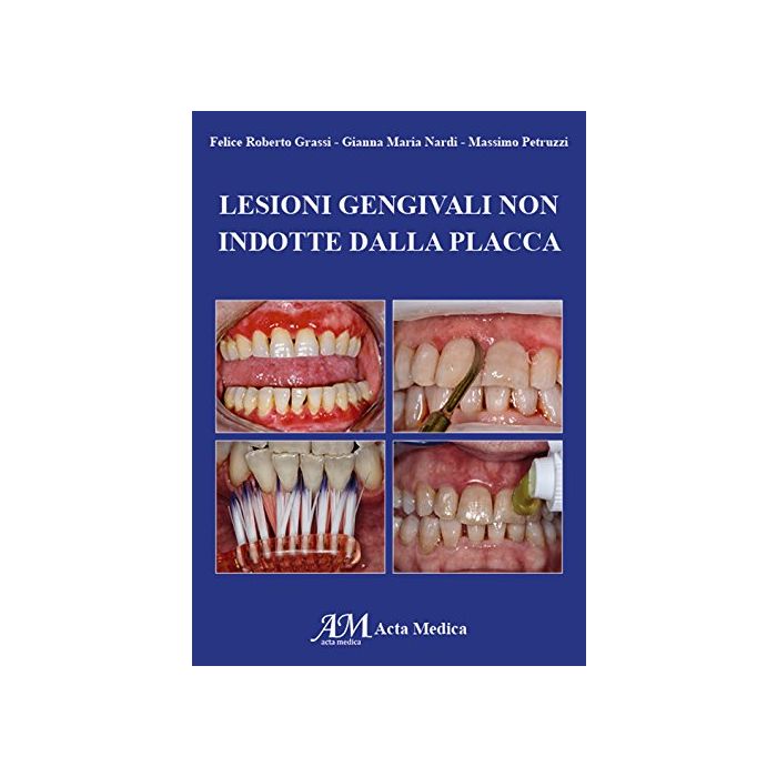 Felice Roberto Grassi - Lesioni gengivali non indotte dalla placca
