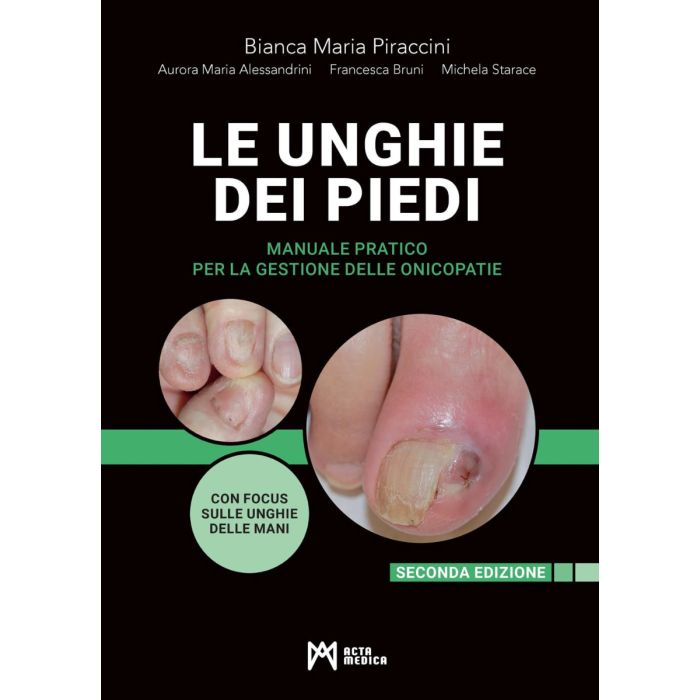Le unghie dei piedi Manuale pratico per la gestione delle onicopatie 2/edizione  Piraccini Bianca Maria Starace Michela Acta Medica