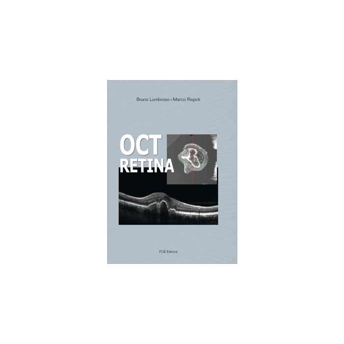 OCT Retina  [Bruno Lumbroso; Marco Rispoli - FABIANO]