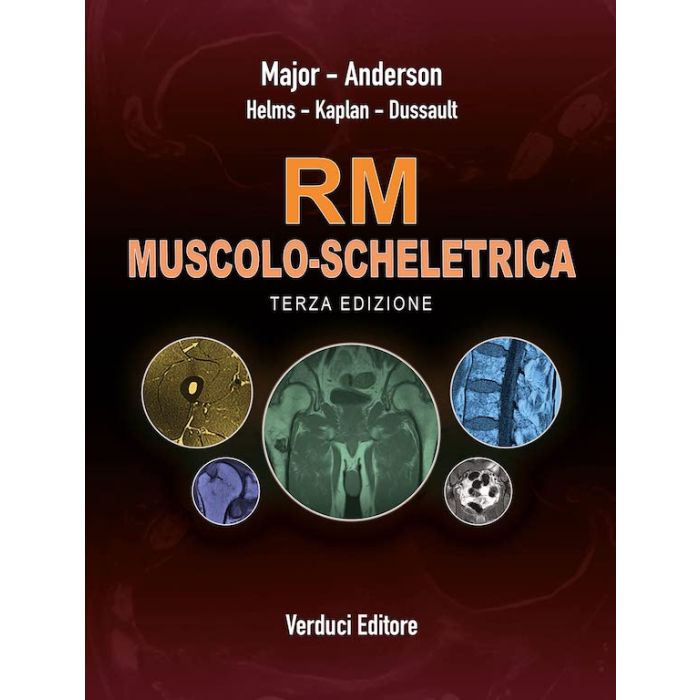 Major Anderson kaplan RM MUSCOLO SCHELETRICA RISONANZA MAGNETICA VERDUCI 