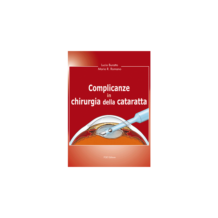 Complicanze in Chirurgia della Cataratta - Buratto - Fabiano Editore