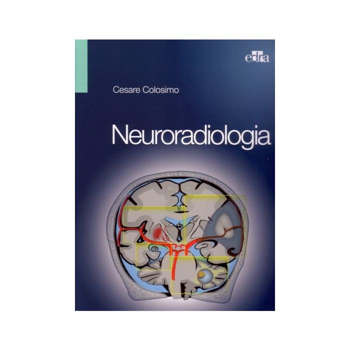 COLOSIMO NEURORADIOLOGIA EDRA