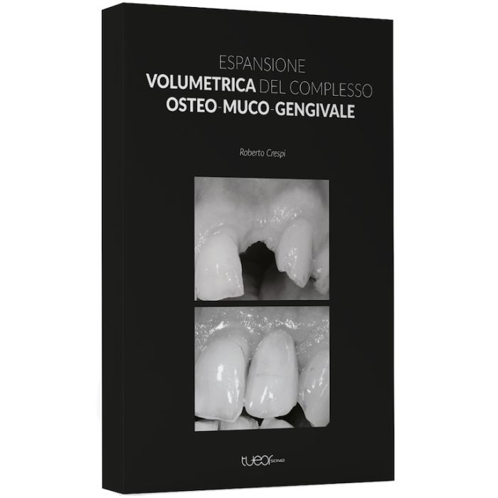 Espansione volumetrica del complesso osteo muco gengivale roberto crespi tueor Espansione volumetrica del complesso osteo muco gengivale roberto crespi tueor