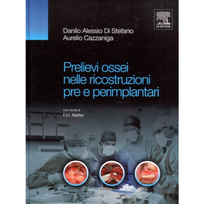 Prelievi Ossei nelle Ricostruzioni pre e perimplantari (con tavole di F.H. Netter) [Di Stefano; Cazzaniga - Elsevier Masson]
