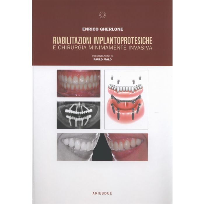 Riabilitazioni Implantoprotesiche e Chirurgia Minimamente Invasiva   [Gherlone - Ariesdue]