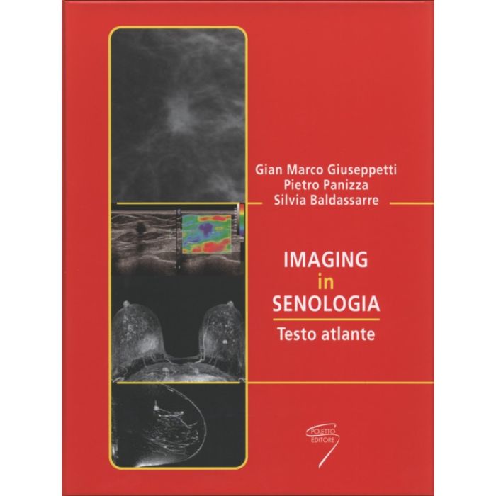 Imaging in senologia gian marco giuseppetti panizza poletto editore libro