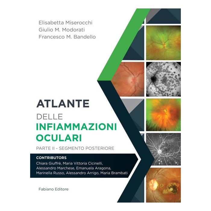 Miserocchi Atlante delle infiammazioni oculari parte 2 segmento postetiore fabiano editore Miserocchi Atlante delle infiammazioni oculari parte 2 segmento postetiore fabiano editore