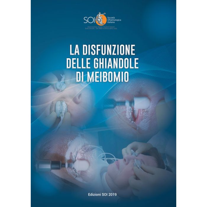 La disfunzione delle ghiandole di meibomio soi societa oftalmologica italiana La disfunzione delle ghiandole di meibomio soi societa oftalmologica italiana