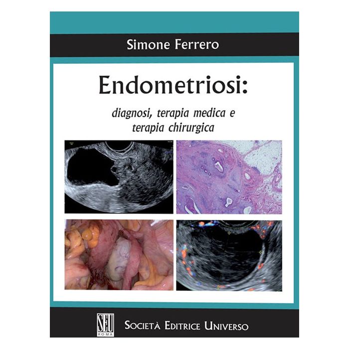 Endometriosi diagnosi terapia medica e chirurgica simone ferrero seu società editrice universo
