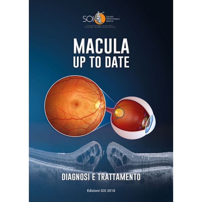 Macula up to date Diagnosi e trattamento Soi 2018