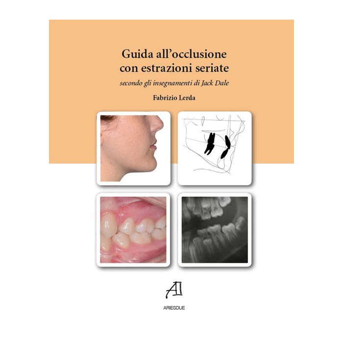 Guida all'occlusione con estrazioni seriate secondo gli insegnamenti di Jack Dale Fabrizio Lerda Ariesdue libro Guida all'occlusione con estrazioni seriate secondo gli insegnamenti di Jack Dale Fabrizio Lerda Ariesdue libro