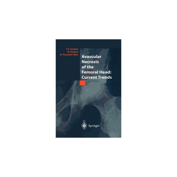 Avascular Necrosis Of The Femoral Head. Current Trends - Santori F. S. ; Santori N. ; Piccinato A. - Springer Verlag Italia - 9788847002333 Avascular Necrosis Of The Femoral Head. Current Trends - Santori F. S. ; Santori N. ; Piccinato A. - Springer Verlag Italia - 9788847002333